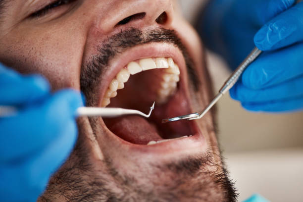 Best Sedation Dentistry  in Mclendon Chisholm, TX
